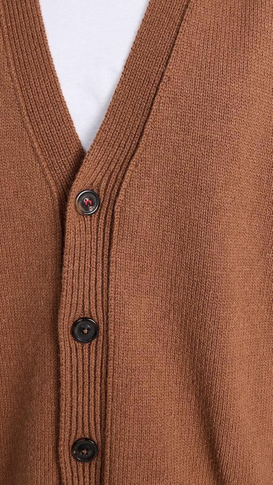 Maison Margiela Distressed Elbow Patch Layered Cardigan | Shopbop Product Image