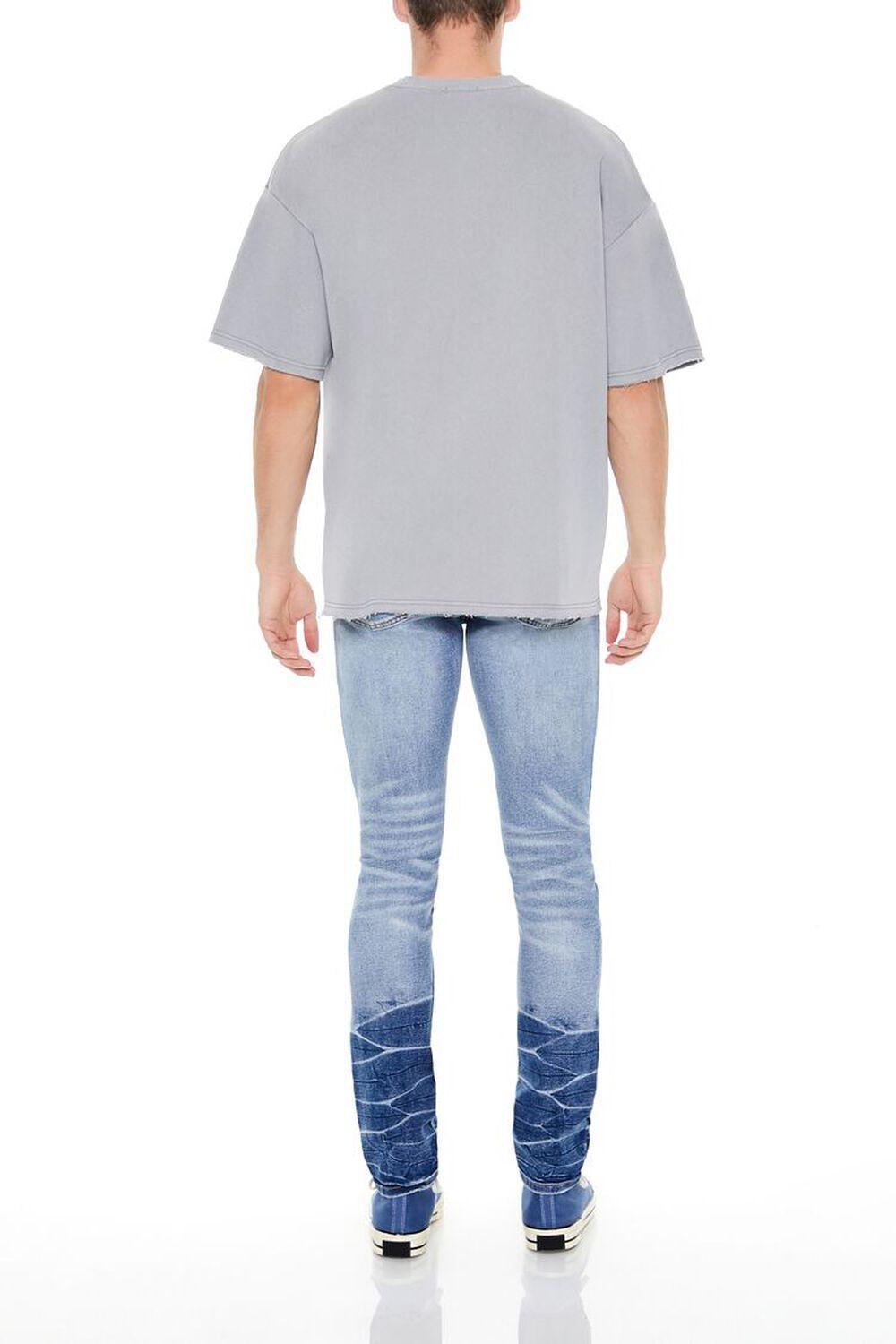Distressed Acid Wash Skinny Jeans | Forever 21 Product Image